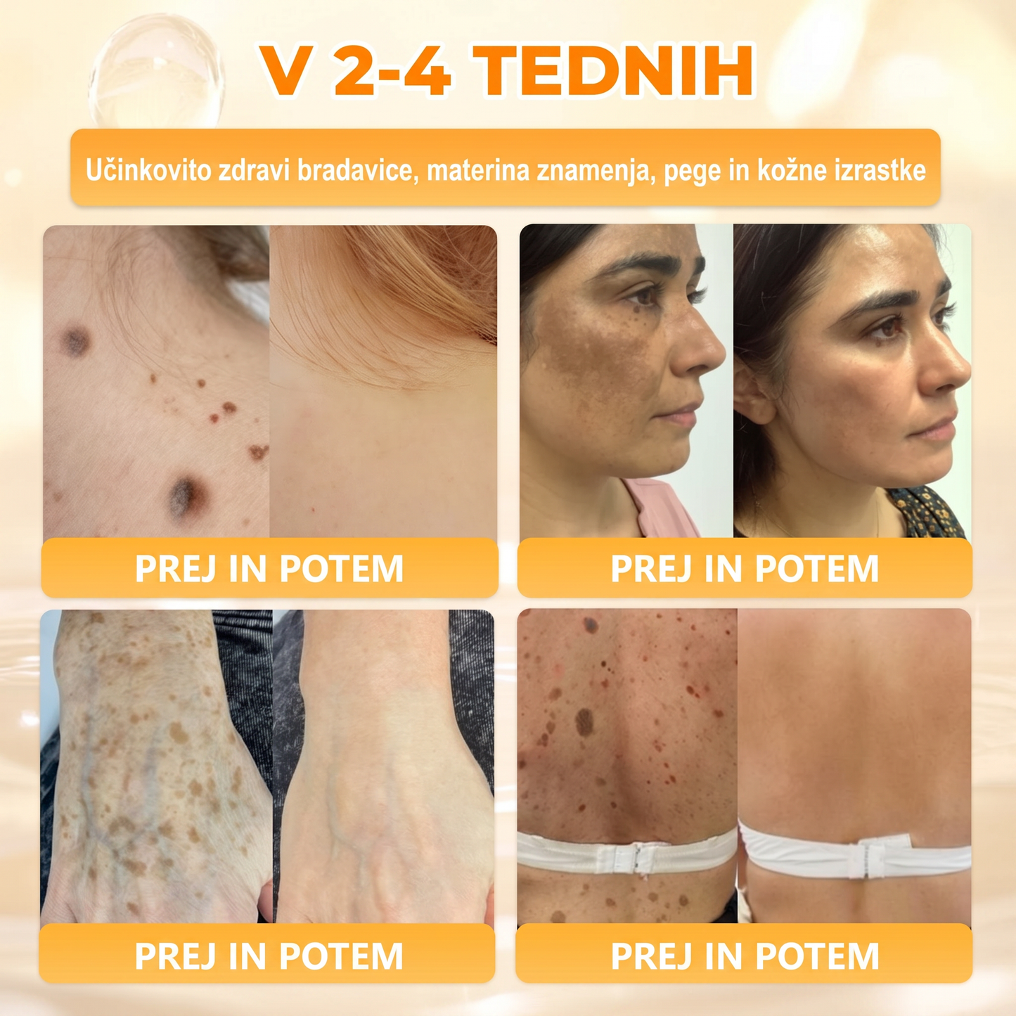 🔥🔥𝐔𝐫𝐚𝐝𝐧𝐚 𝐭𝐫𝐠𝐨𝐯𝐢𝐧𝐚 • 𝐈𝐳𝐝𝐞𝐥𝐚𝐧𝐨 𝐢𝐧 𝐩𝐨𝐬𝐥𝐚𝐧𝐨 𝐢𝐳 𝐒𝐥𝐨𝐯𝐞𝐧𝐢𝐣𝐞🍦𝗗𝗼𝗿𝗺𝗼𝗿𝗻𝗮® Č𝗲𝗯𝗲𝗹𝗷𝗶 𝘀𝘁𝗿𝘂𝗽 𝗖𝗲𝗹𝗼𝘃𝗶𝘁𝗮 𝗸𝗿𝗲𝗺𝗮🌟𝒁𝑨𝑫𝑵𝑱𝑰 𝑫𝑨𝑵 80 % 𝑪𝑬𝑵𝑬𝑱𝑬