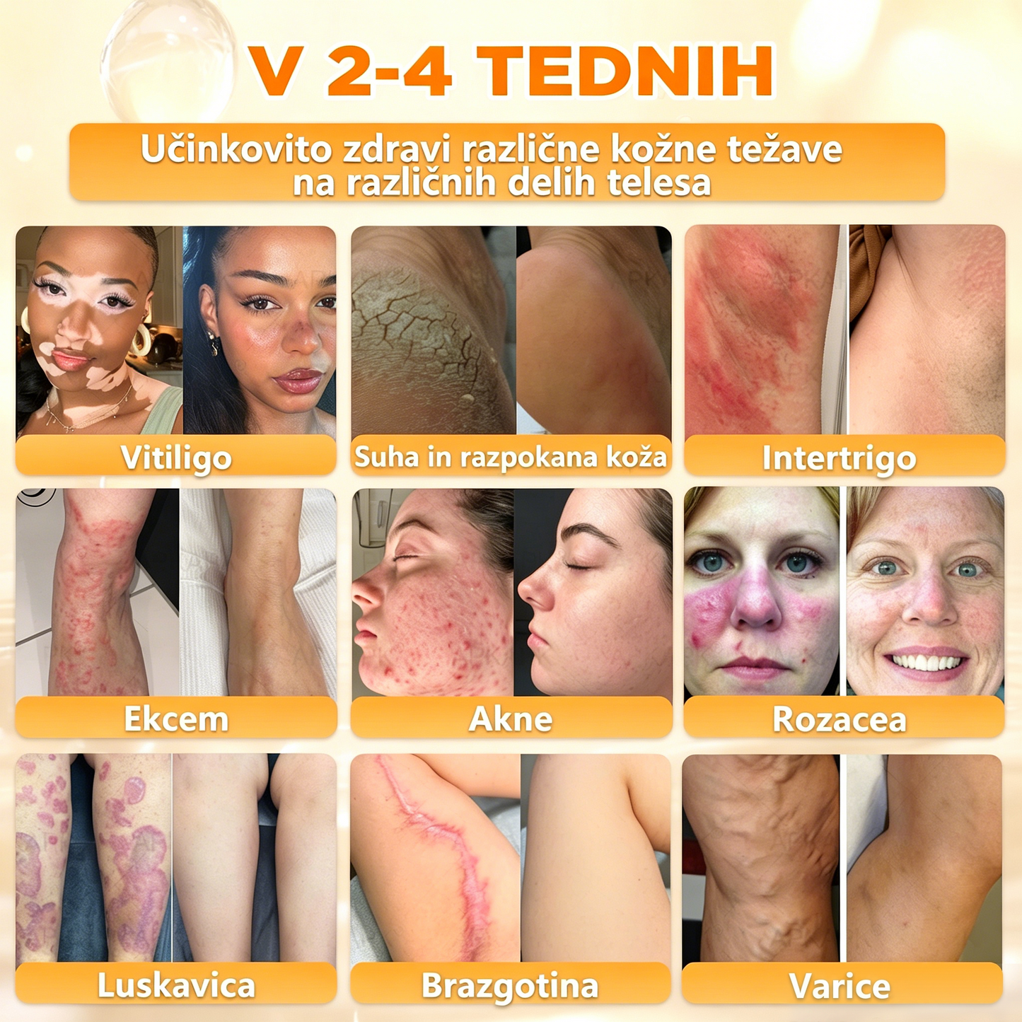 🔥🔥𝐔𝐫𝐚𝐝𝐧𝐚 𝐭𝐫𝐠𝐨𝐯𝐢𝐧𝐚 • 𝐈𝐳𝐝𝐞𝐥𝐚𝐧𝐨 𝐢𝐧 𝐩𝐨𝐬𝐥𝐚𝐧𝐨 𝐢𝐳 𝐒𝐥𝐨𝐯𝐞𝐧𝐢𝐣𝐞🍦𝗗𝗼𝗿𝗺𝗼𝗿𝗻𝗮® Č𝗲𝗯𝗲𝗹𝗷𝗶 𝘀𝘁𝗿𝘂𝗽 𝗖𝗲𝗹𝗼𝘃𝗶𝘁𝗮 𝗸𝗿𝗲𝗺𝗮🌟𝒁𝑨𝑫𝑵𝑱𝑰 𝑫𝑨𝑵 80 % 𝑪𝑬𝑵𝑬𝑱𝑬