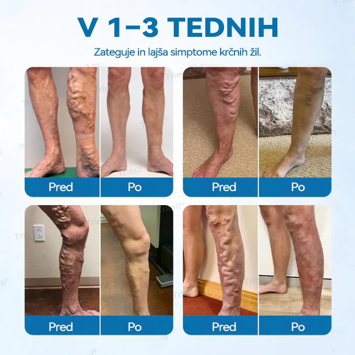 🎖️𝐃𝐢𝐚𝐩𝐚𝘀𝗼𝗻® 𝐙𝐞𝐥𝐢šč𝐧𝐢 𝐒𝐩𝐫𝐞𝐣 𝐕𝐞𝐢𝐧𝐆𝐮𝐚𝐫𝐝 -👨‍⚕𝑲𝒍𝒊𝒏𝒊č𝒏𝒐 𝒅𝒐𝒌𝒂𝒛𝒂𝒏𝒐 𝒐𝒅𝒑𝒓𝒂𝒗𝒍𝒋𝒂 𝒌𝒓č𝒏𝒆 ž𝒊𝒍𝒆 𝒗 𝒔𝒂𝒎𝒐 7 𝒅𝒏𝒆𝒉!