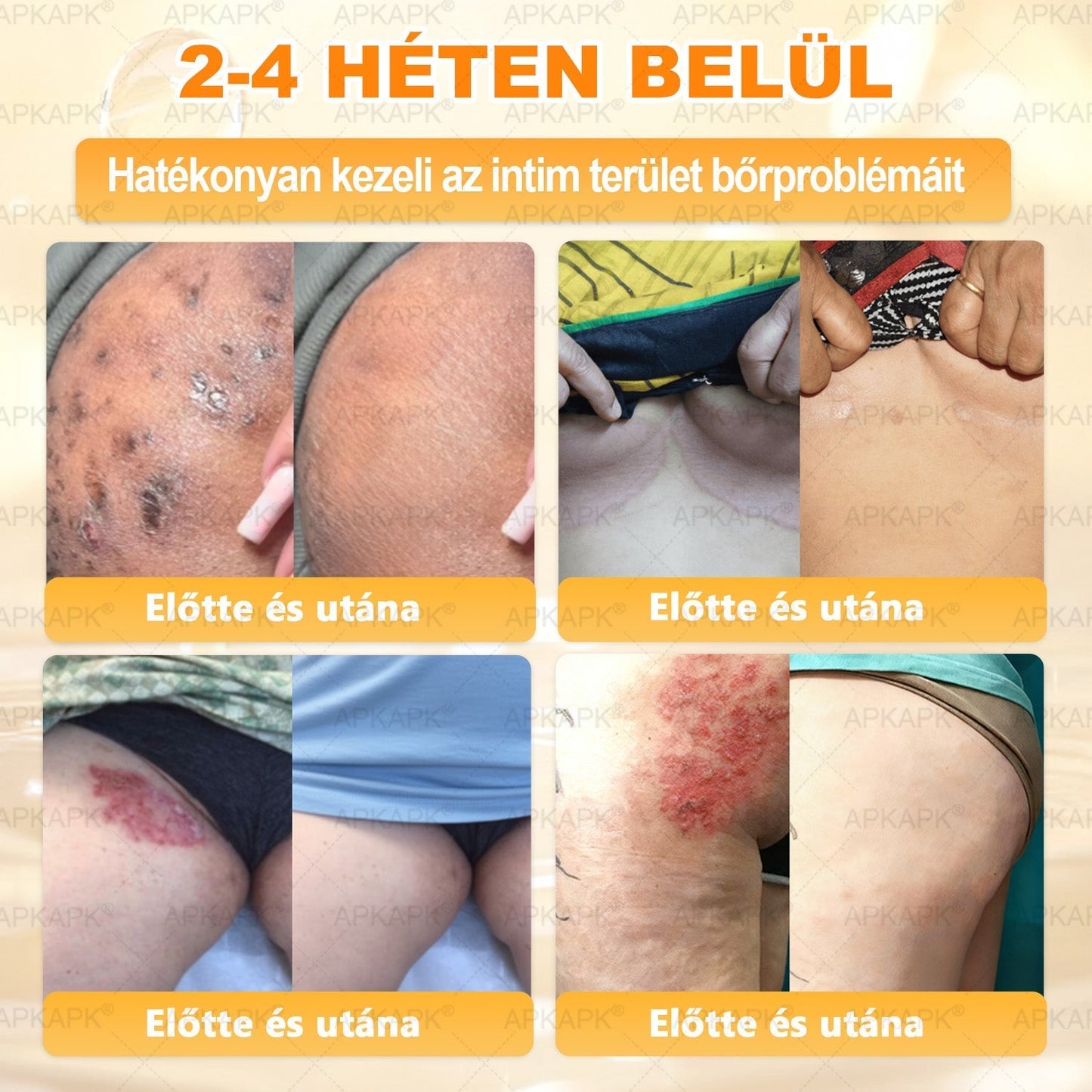 🔥🔥Ajánlott a Semmelweis Kórház által · BENU hivatalos üzlet✨𝖠𝖯𝖪𝖠𝖯𝖪® méhméreges bőrmegújító krém