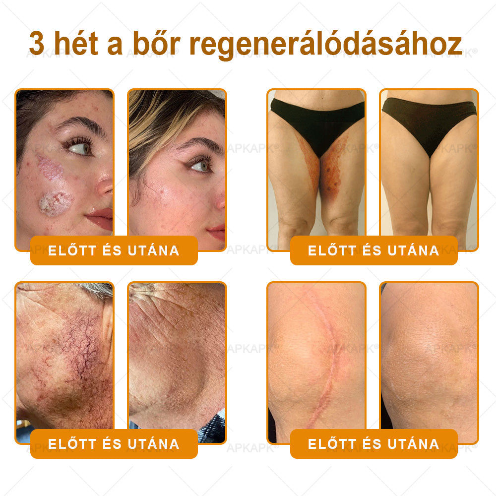 🔥🔥Ajánlott a Semmelweis Kórház által · BENU hivatalos üzlet✨𝖠𝖯𝖪𝖠𝖯𝖪® méhméreges bőrmegújító krém