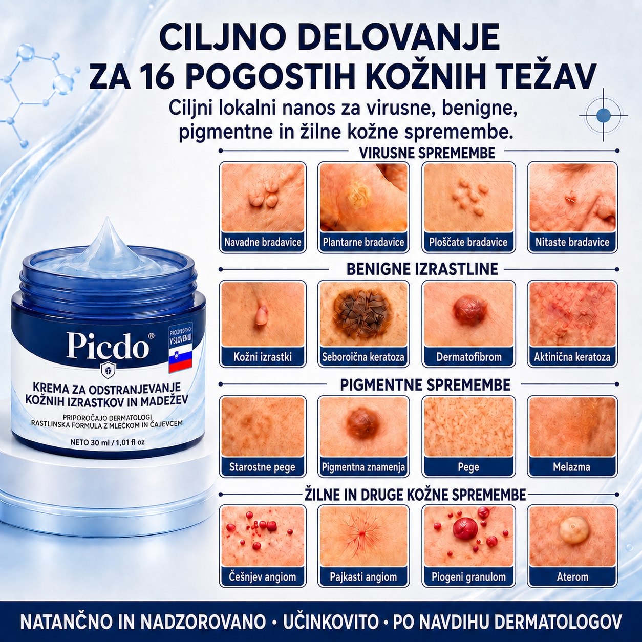 𝐏𝐢𝐜𝐝𝐨®🪷 7-𝒅𝒏𝒆𝒗𝒏𝒂 𝒌𝒓𝒆𝒎𝒂 𝒛𝒂 𝒐𝒅𝒔𝒕𝒓𝒂𝒏𝒋𝒆𝒗𝒂𝒏𝒋𝒆 𝒌𝒐ž𝒏𝒊𝒉 𝒊𝒛𝒓𝒂𝒔𝒕𝒌𝒐𝒗 𝒊𝒏 𝒎𝒂𝒅𝒆ž𝒆𝒗 🩵 (Formula brez bolečin in brez brazgotin) 💪