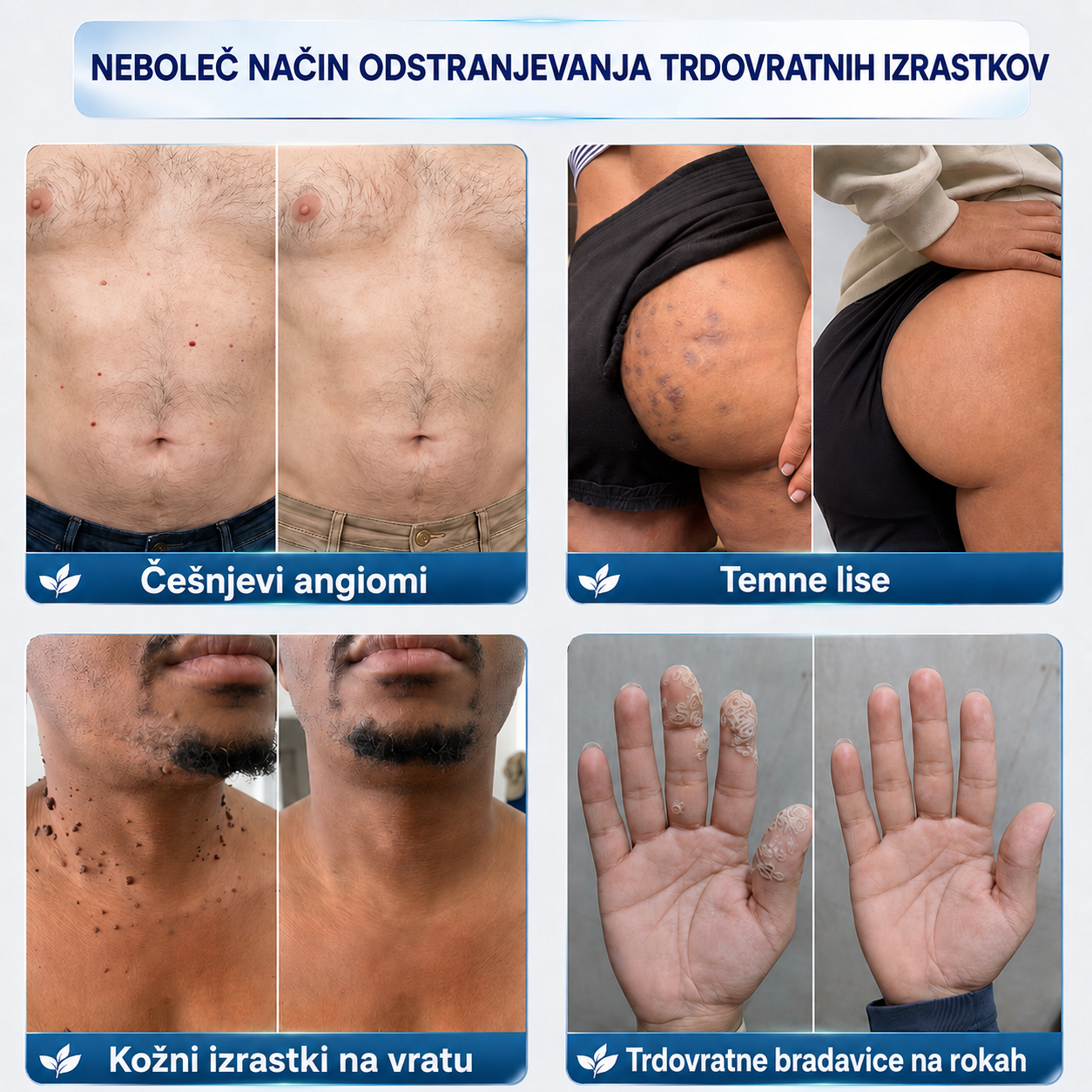 𝐏𝐢𝐜𝐝𝐨®🪷 7-𝒅𝒏𝒆𝒗𝒏𝒂 𝒌𝒓𝒆𝒎𝒂 𝒛𝒂 𝒐𝒅𝒔𝒕𝒓𝒂𝒏𝒋𝒆𝒗𝒂𝒏𝒋𝒆 𝒌𝒐ž𝒏𝒊𝒉 𝒊𝒛𝒓𝒂𝒔𝒕𝒌𝒐𝒗 𝒊𝒏 𝒎𝒂𝒅𝒆ž𝒆𝒗 🩵 (Formula brez bolečin in brez brazgotin) 💪